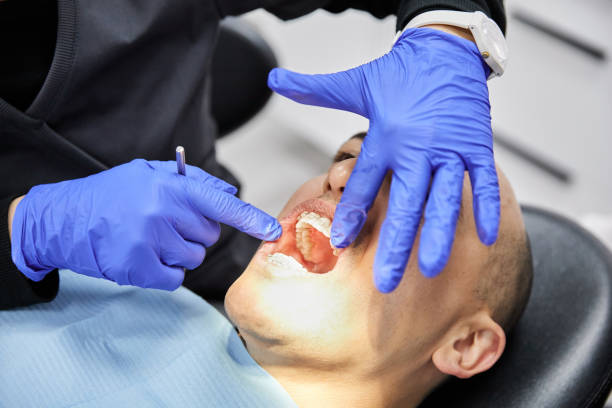 Best Broken Tooth Emergency  in Thompson Falls, MT