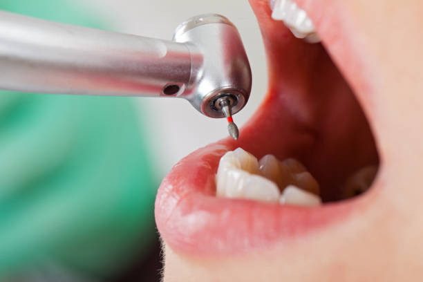 Best Knocked-Out Tooth Emergency  in Thompson Falls, MT